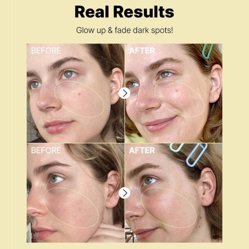 CosRx The Vitamin C 23 Super Vitamin E & Hyaluronic Acid Serum 20g